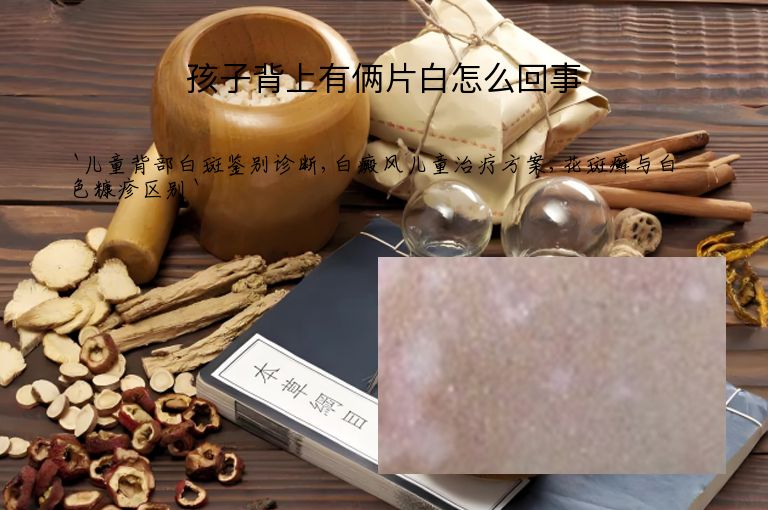 孩子背上有俩片白怎么回事