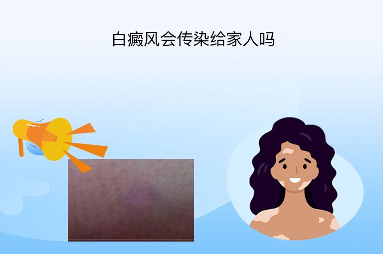 https://www.bdfsjzyy.com/d/file/p/386b575ff5ffde703dd3b3448194050b.jpeg