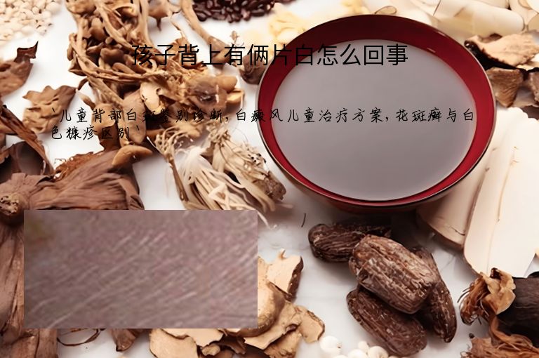 孩子背上有俩片白怎么回事