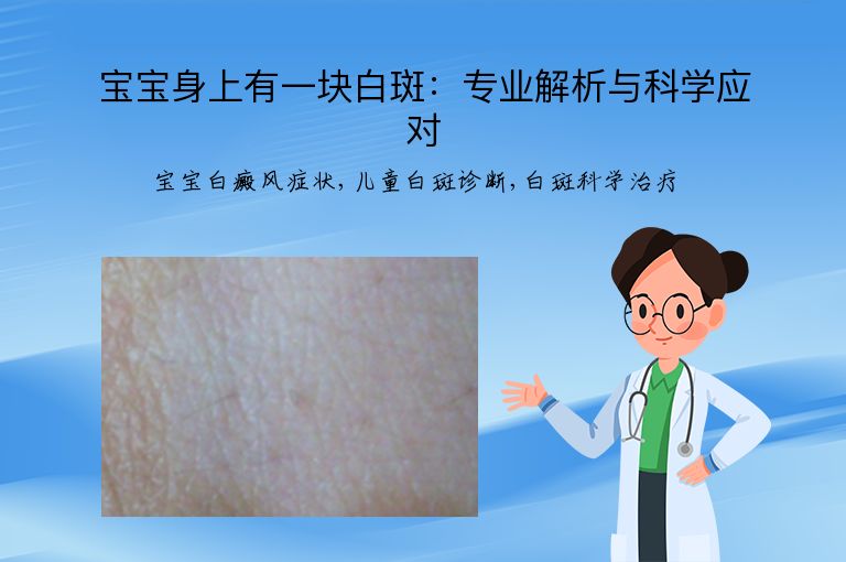 宝宝身上有一块白斑：专业解析与科学应对”