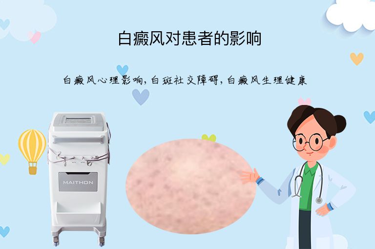白癜风对患者的影响”