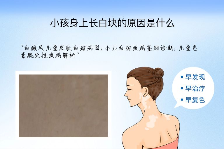 https://www.bdfsjzyy.com/d/file/p/7b233fe02276db39538d9d117345ef68.jpeg