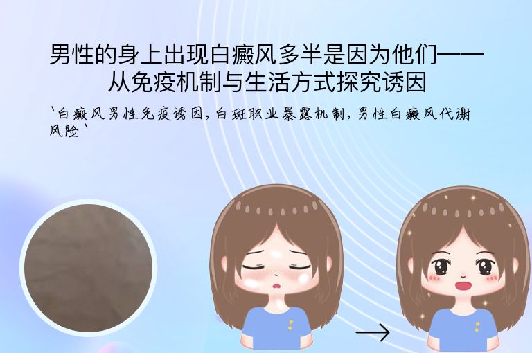 男性的身上出现白癜风多半是因为他们——从免疫机制与生活方式探究诱因