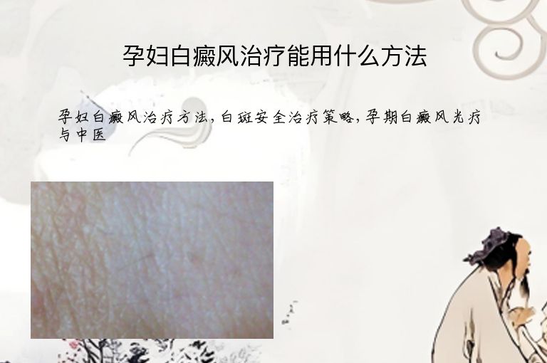 孕妇白癜风治疗能用什么方法”