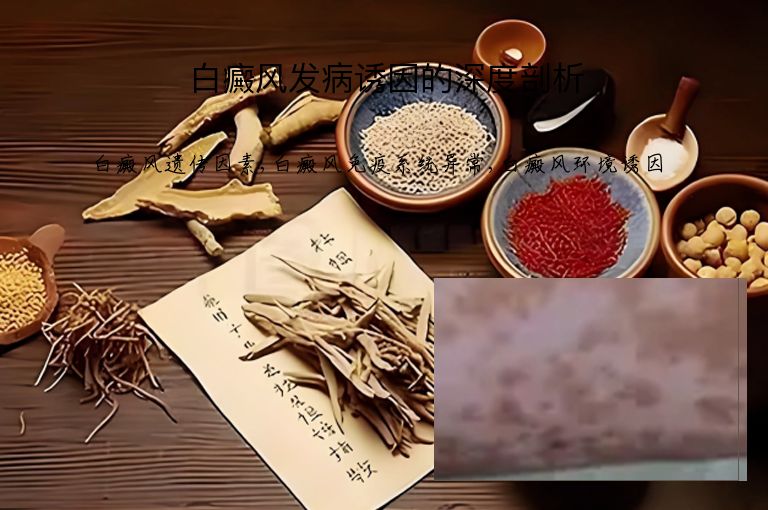 白癜风发病诱因的深度剖析”