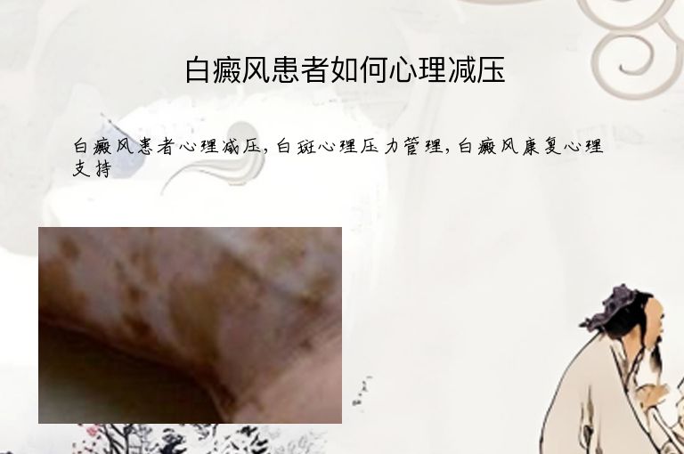 白癜风患者如何心理减压”