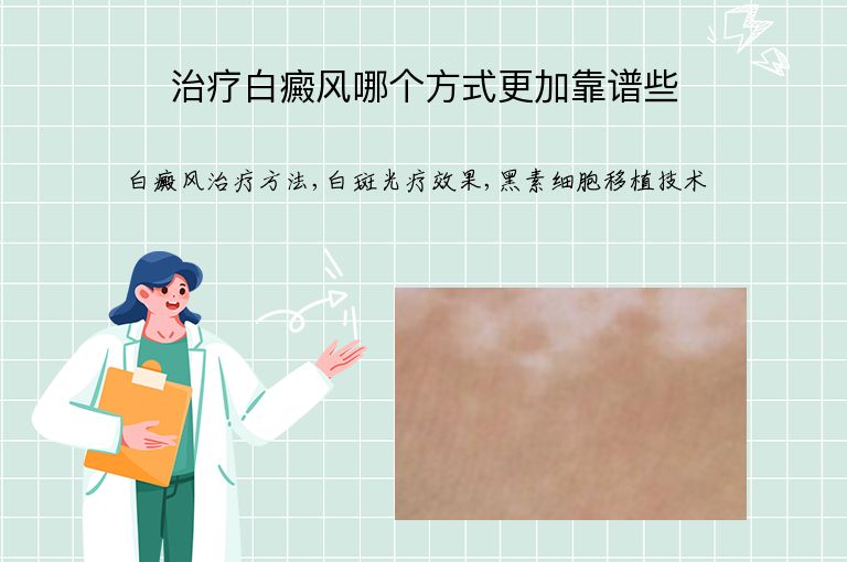 治疗白癜风哪个方式更加靠谱些”