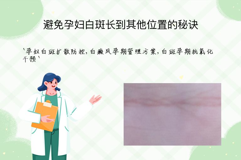 避免孕妇白斑长到其他位置的秘诀