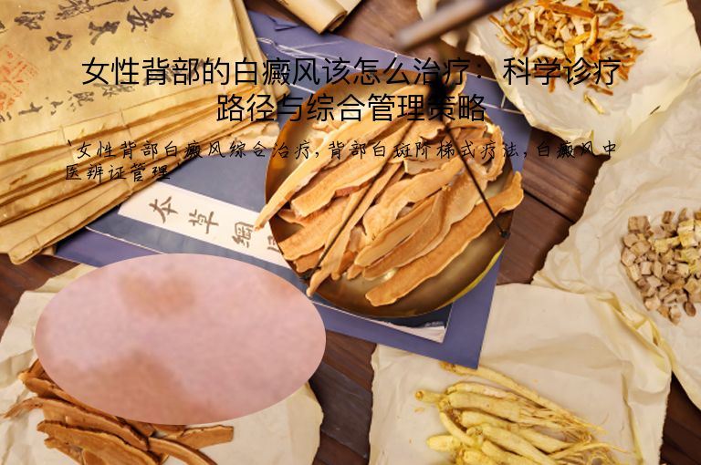 女性背部的白癜风该怎么治疗:科学诊疗路径与综合管理策略
