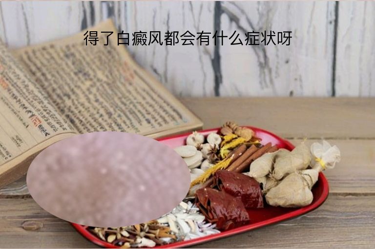 得了白癜风都会有什么症状呀