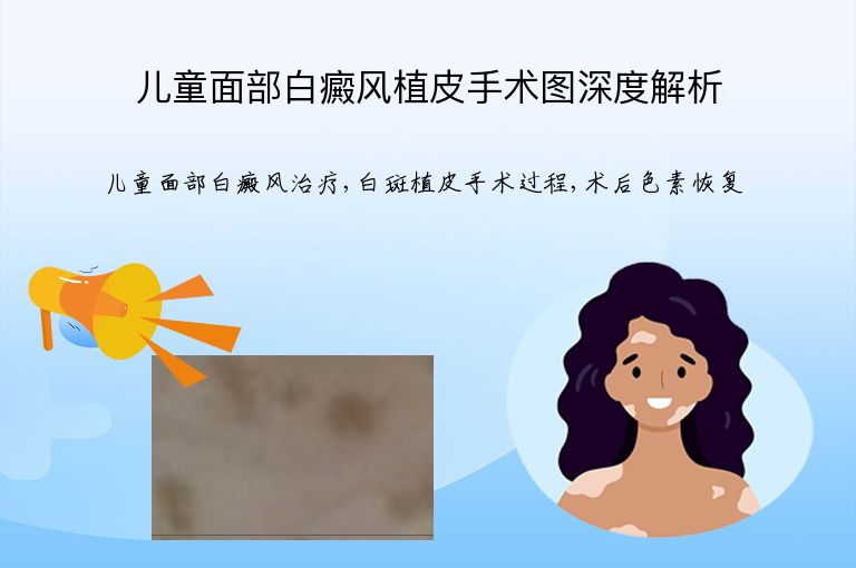 https://www.bdfsjzyy.com/d/file/p/427ef9ca408bf527c7ad61f0a42e2a28.jpeg