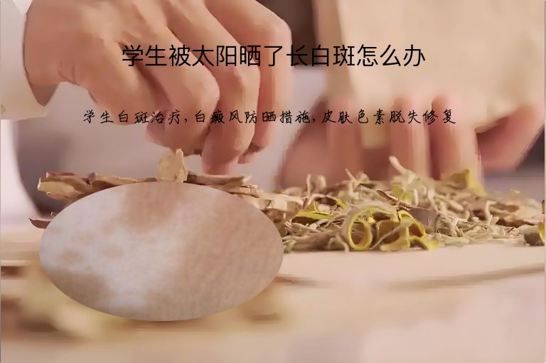 学生被太阳晒了长白斑怎么办”