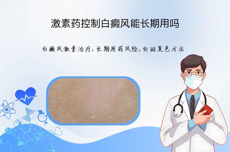 激素药控制白癜风能长期用吗”