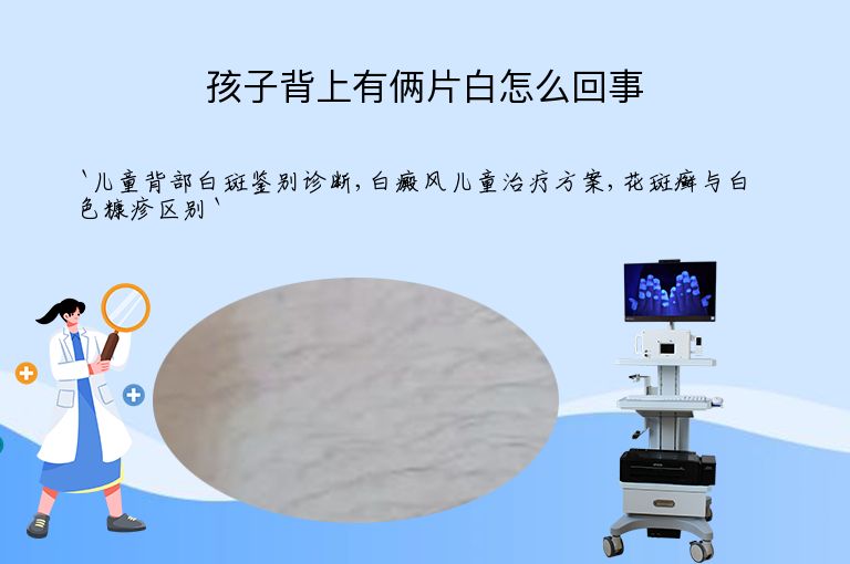 孩子背上有俩片白怎么回事