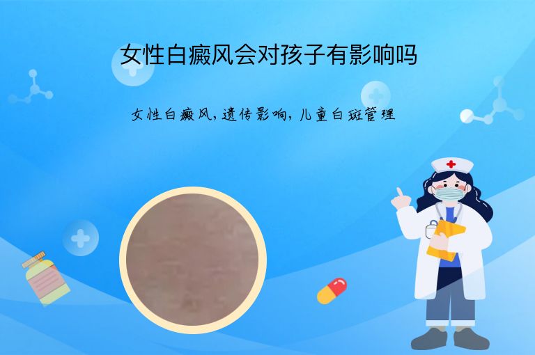 女性白癜风会对孩子有影响吗”