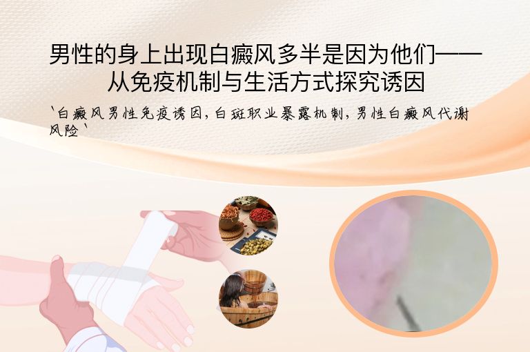 男性的身上出现白癜风多半是因为他们——从免疫机制与生活方式探究诱因