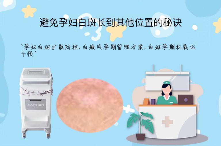 避免孕妇白斑长到其他位置的秘诀