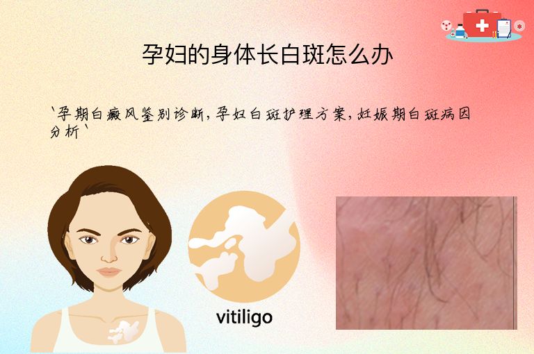 孕妇的身体长白斑怎么办”