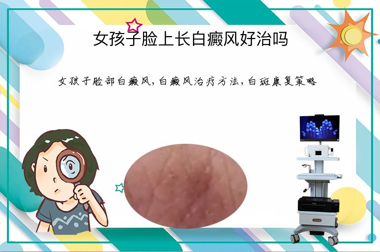 女孩子脸上长白癜风好治吗”