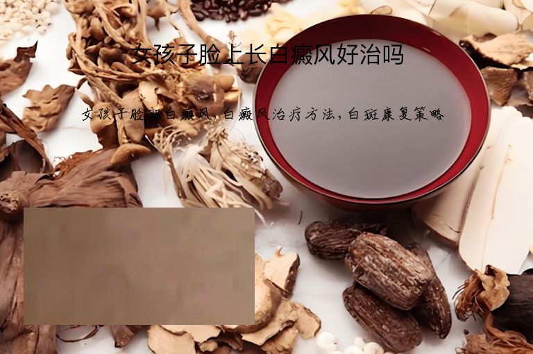女孩子脸上长白癜风好治吗”