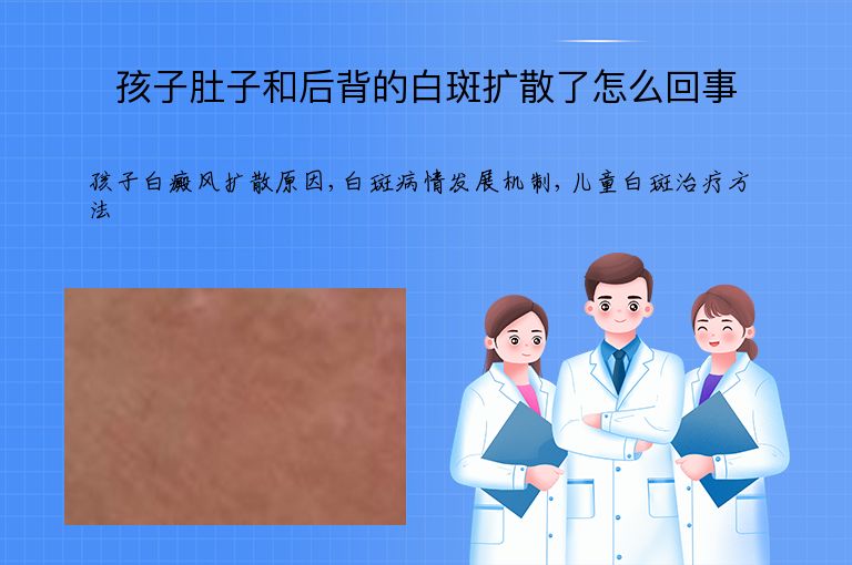 孩子肚子和后背的白斑扩散了怎么回事”