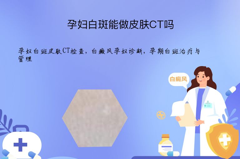 https://www.bdfsjzyy.com/d/file/p/9dd7f2ec1561e32e027e009600de1871.jpeg
