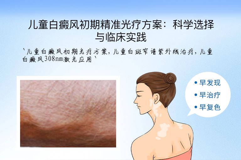 儿童白癜风初期精准光疗方案:科学选择与临床实践