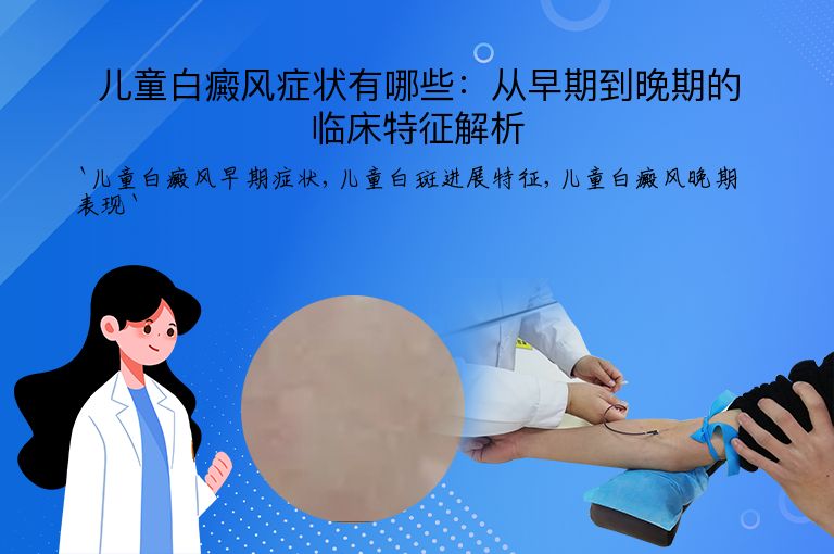 儿童白癜风症状有哪些:从早期到晚期的临床特征解析