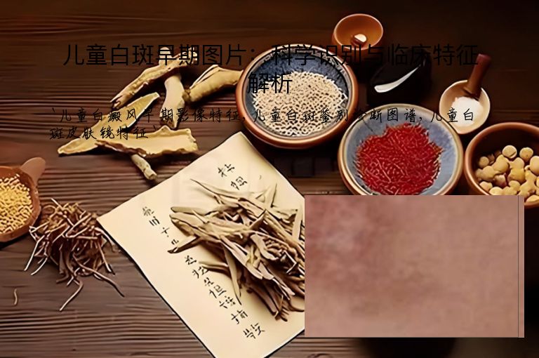 儿童白斑早期图片:科学识别与临床特征解析