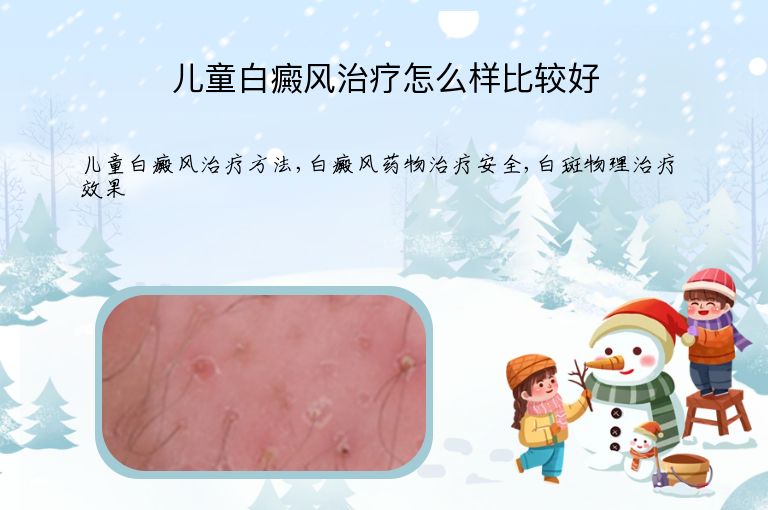 儿童白癜风治疗怎么样比较好”