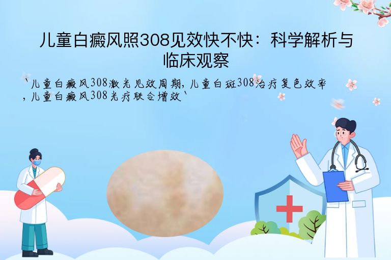 儿童白癜风照308见效快不快:科学解析与临床观察