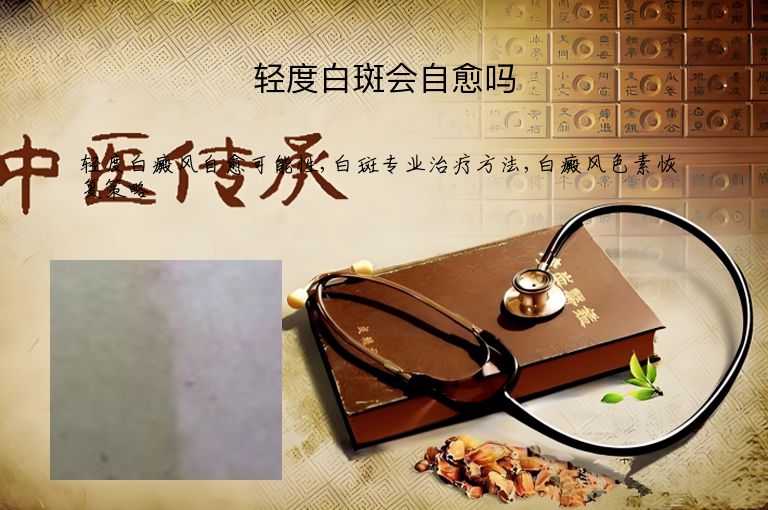 轻度白斑会自愈吗”