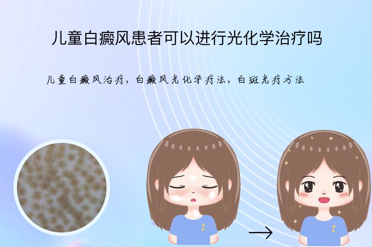 儿童白癜风患者可以进行光化学治疗吗”
