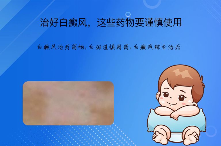 治好白癜风，这些药物要谨慎使用”