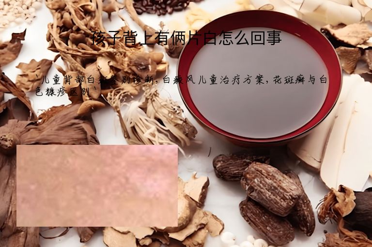 孩子背上有俩片白怎么回事