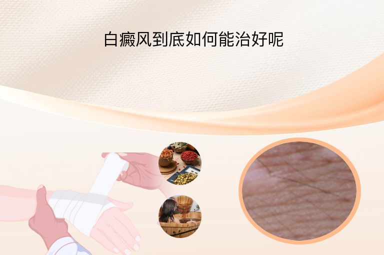 https://www.bdfsjzyy.com/d/file/p/b822eb4d77b33f9f7ed13fdc36575e7e.jpeg