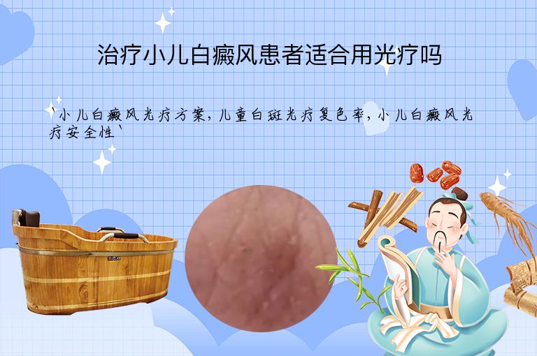 治疗小儿白癜风患者适合用光疗吗