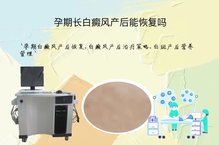 孕期长白癜风产后能恢复吗”