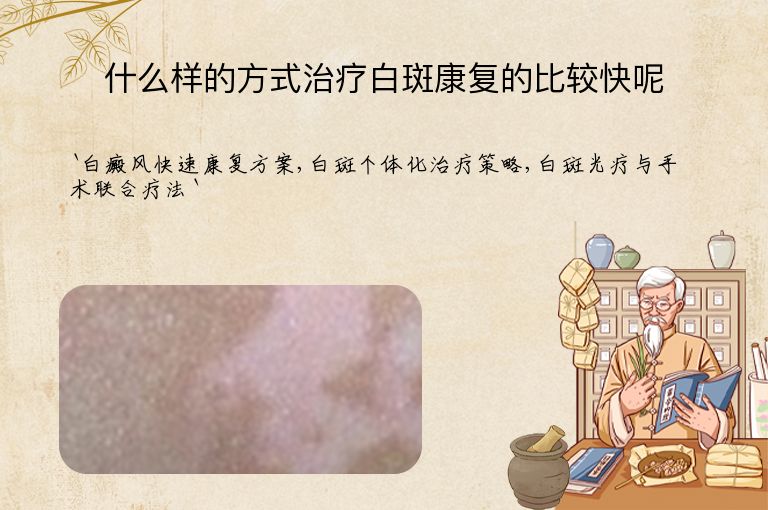 什么样的方式治疗白斑康复的比较快呢