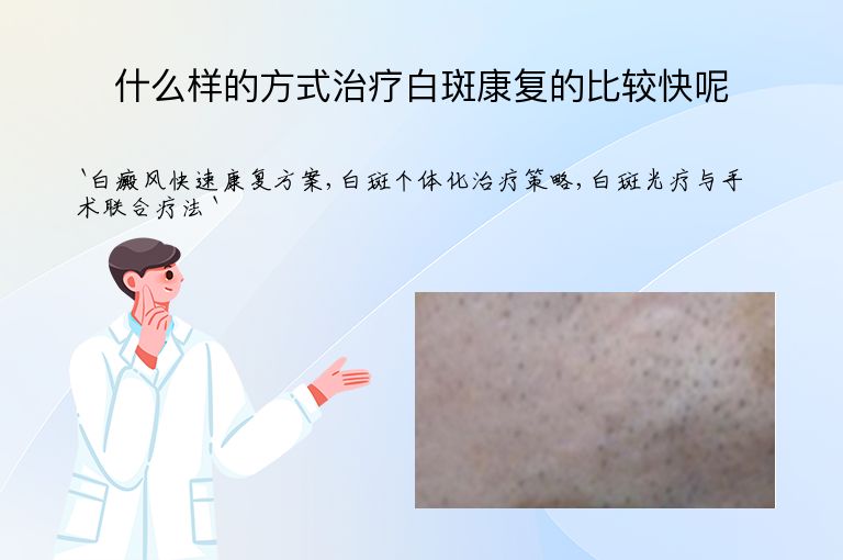 什么样的方式治疗白斑康复的比较快呢