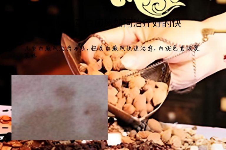 轻度儿童白癜风如何治疗好的快”