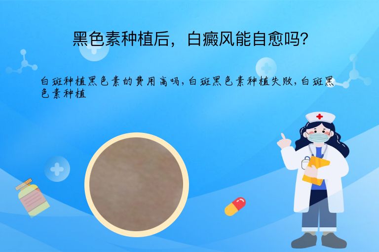 黑色素种植后，白癜风能自愈吗？”