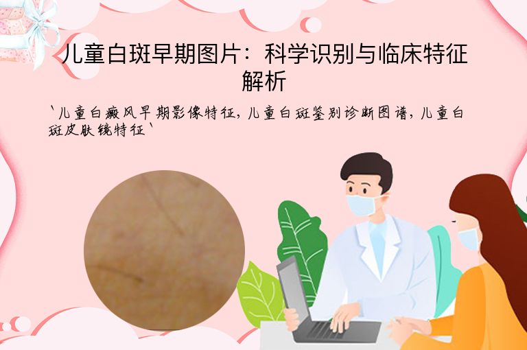 儿童白斑早期图片：科学识别与临床特征解析