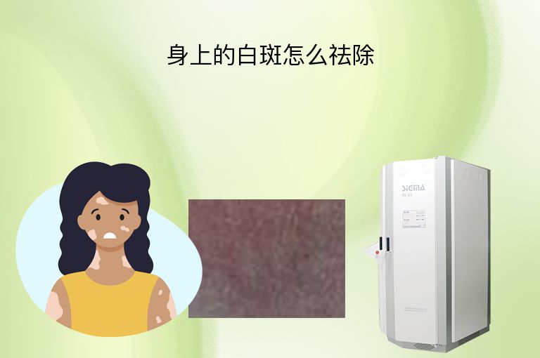 身上的白斑怎么祛除”
