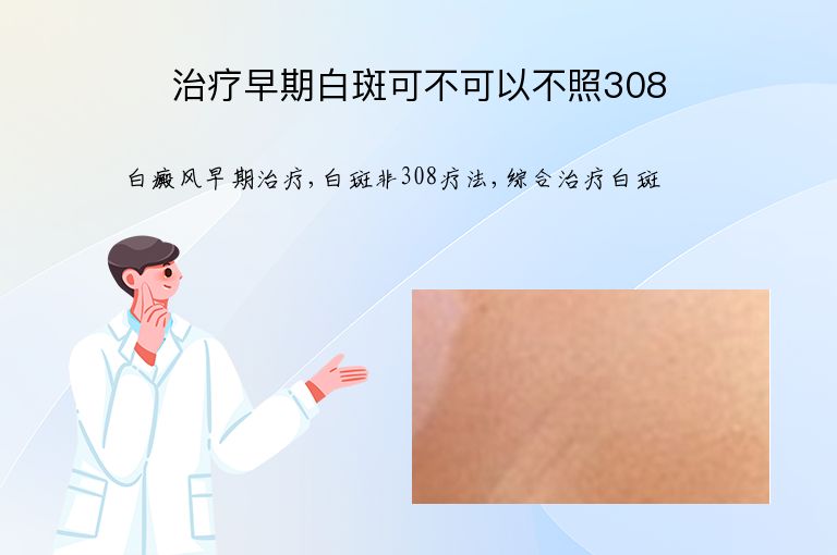 治疗早期白斑可不可以不照308”