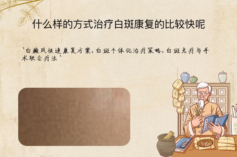 什么样的方式治疗白斑康复的比较快呢