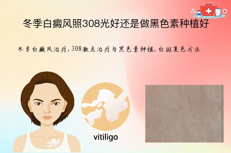 冬季白癜风照308光好还是做黑色素种植好”