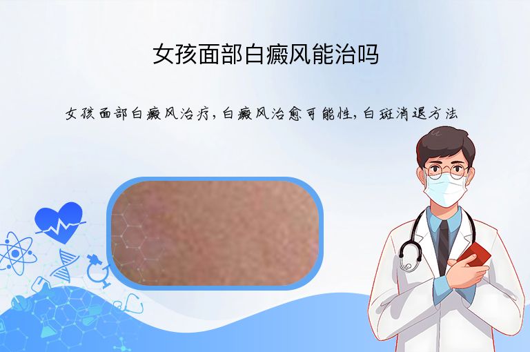 女孩面部白癜风能治吗”