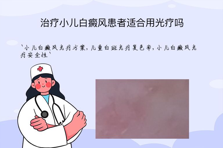 治疗小儿白癜风患者适合用光疗吗