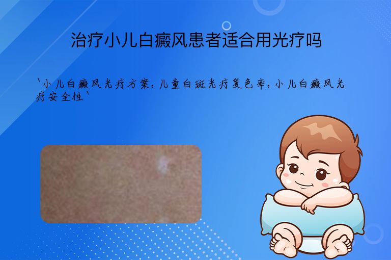治疗小儿白癜风患者适合用光疗吗